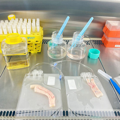 В ГНЦ ФМБЦ им.А.И.Бурназяна ФМБА России успешно функционирует криобанк донорских сосудистых аллографтов 